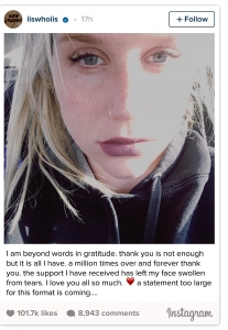 Kesha